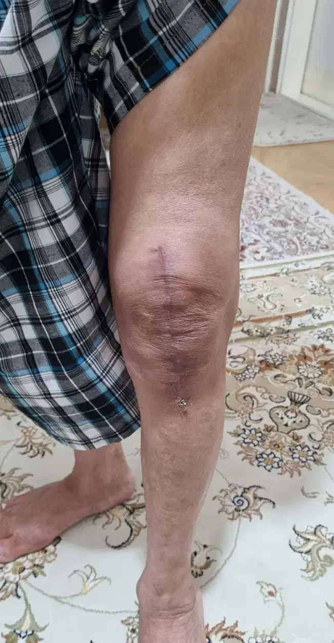 خدمات تخصصی فیزیوتراپی در منزل شیراز|خدمات آرایشگری و زیبایی|شیراز, زرهی|دیوار