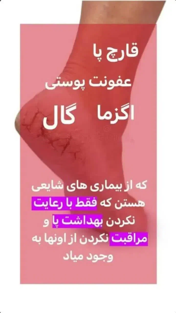 کرممراقبتازپاازبرندویتابلا|آرایشی، بهداشتی، درمانی|جوانرود, |دیوار