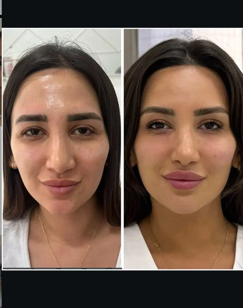 کلینیک تخصصی ژل و فیلر،لیپو و..|خدمات آرایشگری و زیبایی|شهریار, شهریار|دیوار