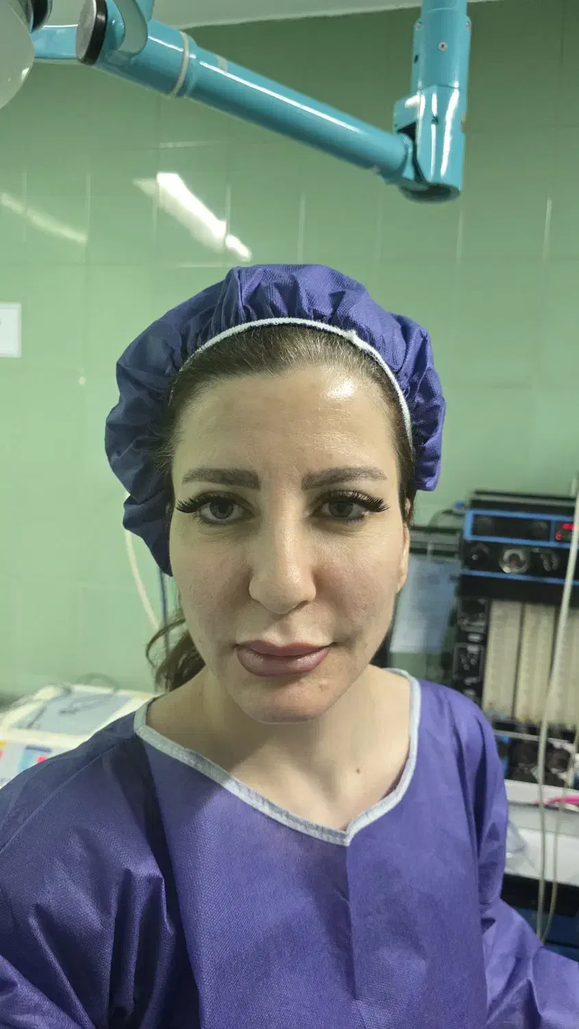 بینی بلفارو غبغب بوتاکس فیلر بادی بیکینی مامو|خدمات آرایشگری و زیبایی|تهران, نیاوران|دیوار