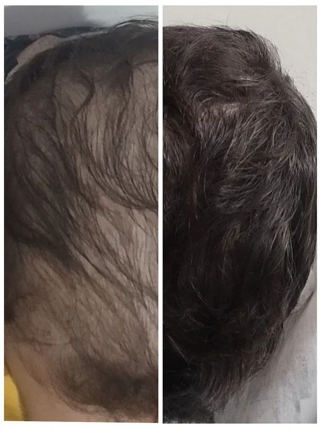 هیرفیلر مو دکتر CYJ|خدمات آرایشگری و زیبایی|تهران, تهرانسر غربی|دیوار