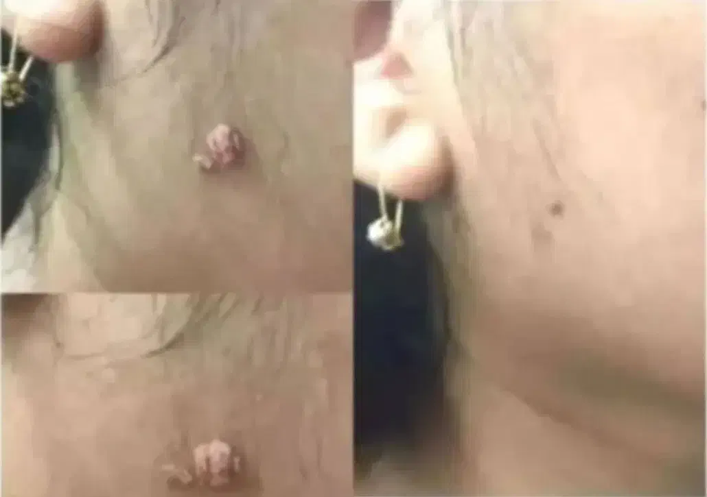 بهبودی ززگیل و تبخاال تظمینی|آرایشی، بهداشتی، درمانی|آبادان, |دیوار