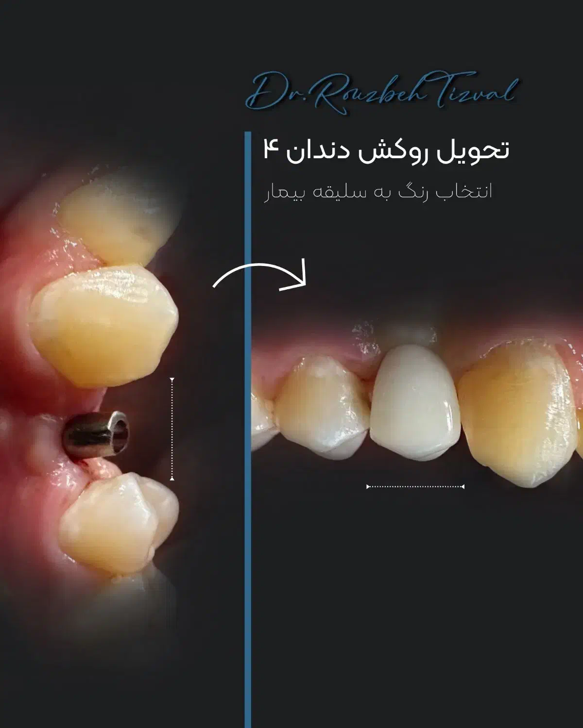 ادمین و گرافیست پیج اینستاگرام هستم|استخدام رایانه و فناوری اطلاعات|تهران, تجریش|دیوار