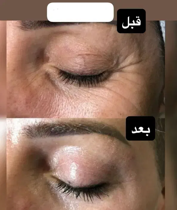 بیوممتیک|حراج|تهران, ترمینال غرب|دیوار