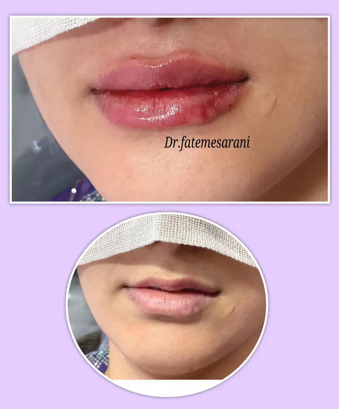 جشنواره پاییزی زیبایی در کلینیک ما آغاز شد...|خدمات آرایشگری و زیبایی|زاهدان, |دیوار