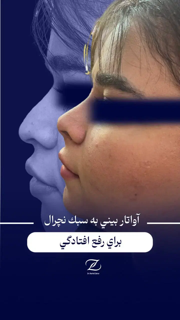 اقساط،لیفت بایوفیس صورت مزوژل بوتاکس اصلاح بینی نخ|خدمات زیبایی و سلامت|مشهد, احمدآباد|دیوار