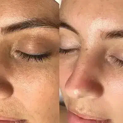 مدل فیشال با بخشی از هزینه مواد|خدمات آرایشگری و زیبایی|تربت‌حیدریه, مظفریه|دیوار