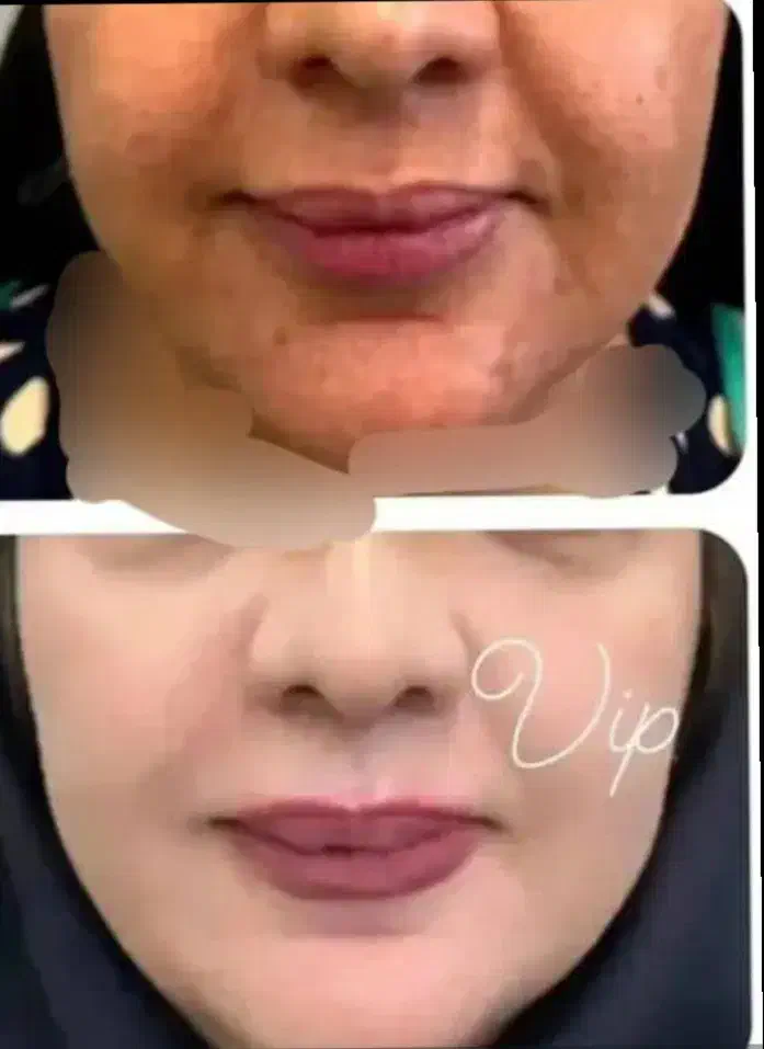 کرم وی ای پی اصل صدرصد تضمینی و بدون بازگشت|آرایشی، بهداشتی، درمانی|یاسوج, |دیوار