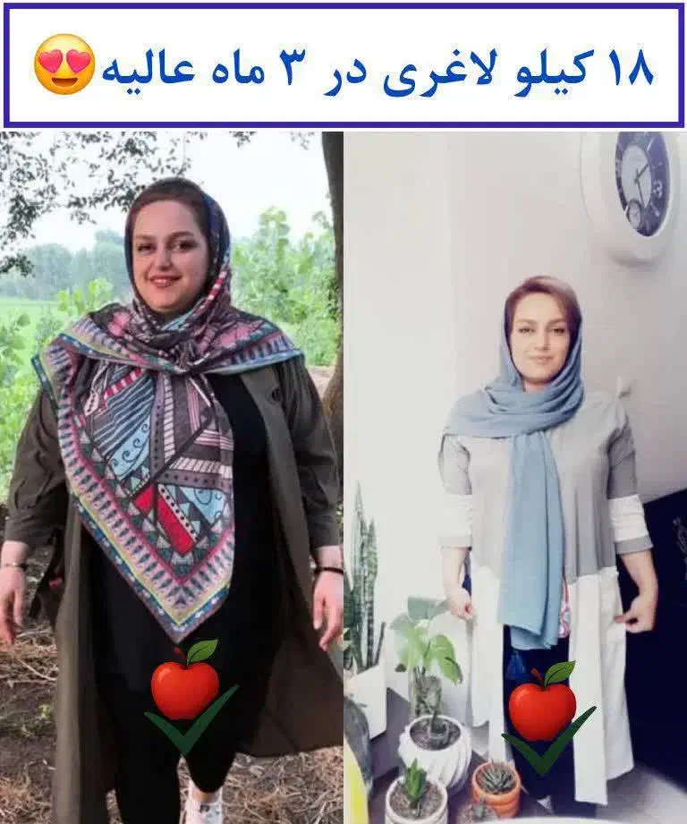 اضافه وزن وپوست آسیب دیده از شما ولاغری از ما|آرایشی، بهداشتی، درمانی|گلپایگان, |دیوار