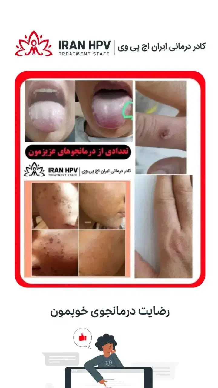 بهبود زگیل/تبخال/hpv/hsv|آرایشی، بهداشتی، درمانی|قم, یخچال قاضی|دیوار