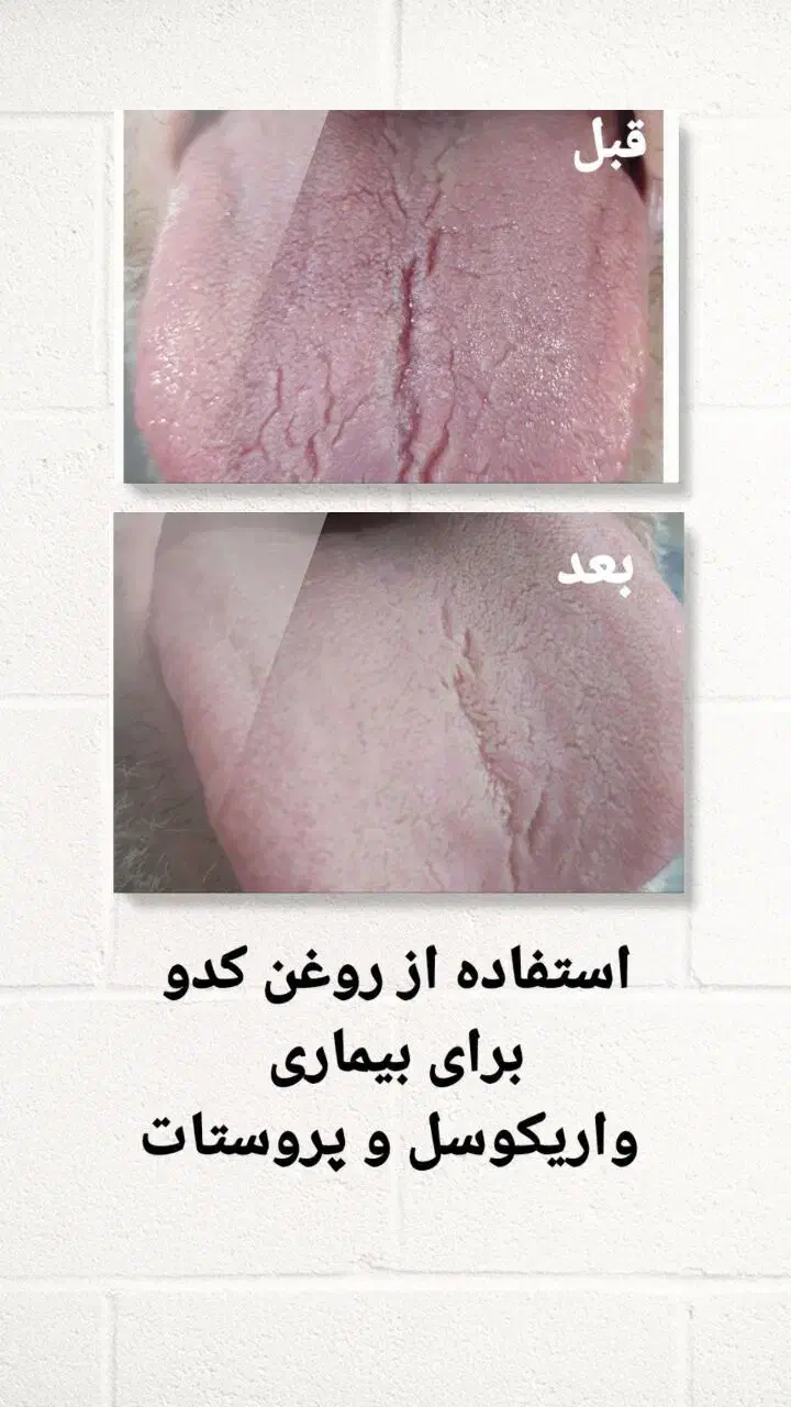 روغن های گیاهی کاژان|آرایشی، بهداشتی، درمانی|تربت‌حیدریه, شهرک ولیعصر|دیوار