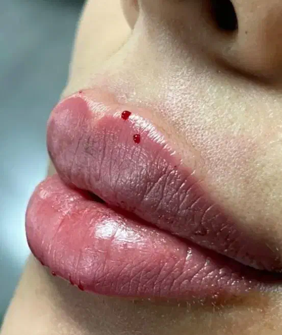 مدل ژل لب وبوتاکس فیلروغیره|خدمات آرایشگری و زیبایی|اسلام‌شهر, شهرک توحید|دیوار