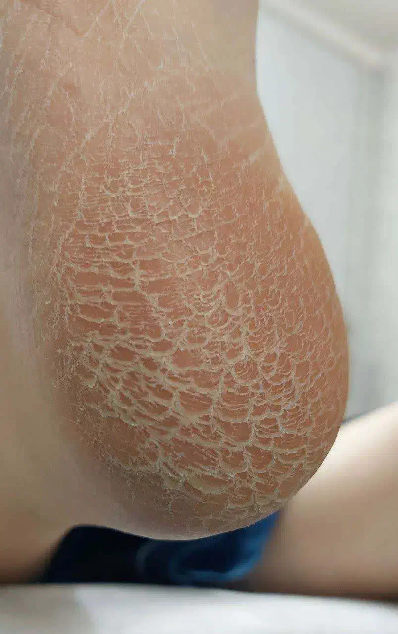 پدیکور کلینیکال درمانی|خدمات آرایشگری و زیبایی|قم, زنبیل آباد|دیوار