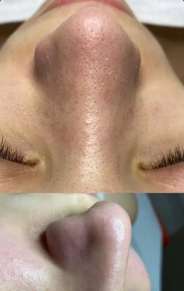 جشنواره پاکسازی پوست|خدمات آرایشگری و زیبایی|اصفهان, چرخاب|دیوار