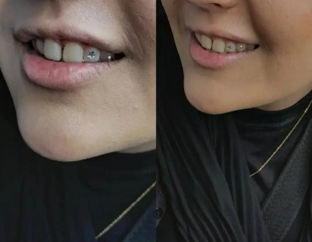 آموزش و اجرای پرسینگ|خدمات آرایشگری و زیبایی|نیشابور, ناسیونال|دیوار