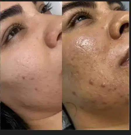 پاکسازی پوست|خدمات آرایشگری و زیبایی|اسلامآباد غرب, |دیوار