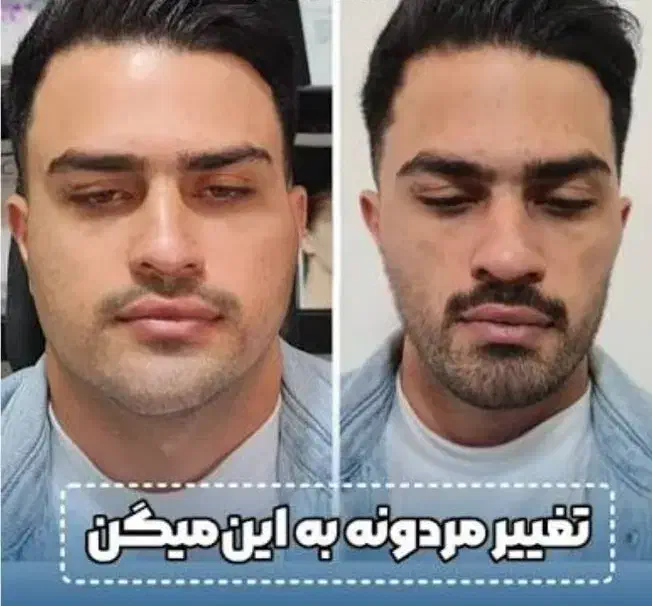 چاقی صورت و بدن|آرایشی، بهداشتی، درمانی|اهواز, کیان اباد|دیوار