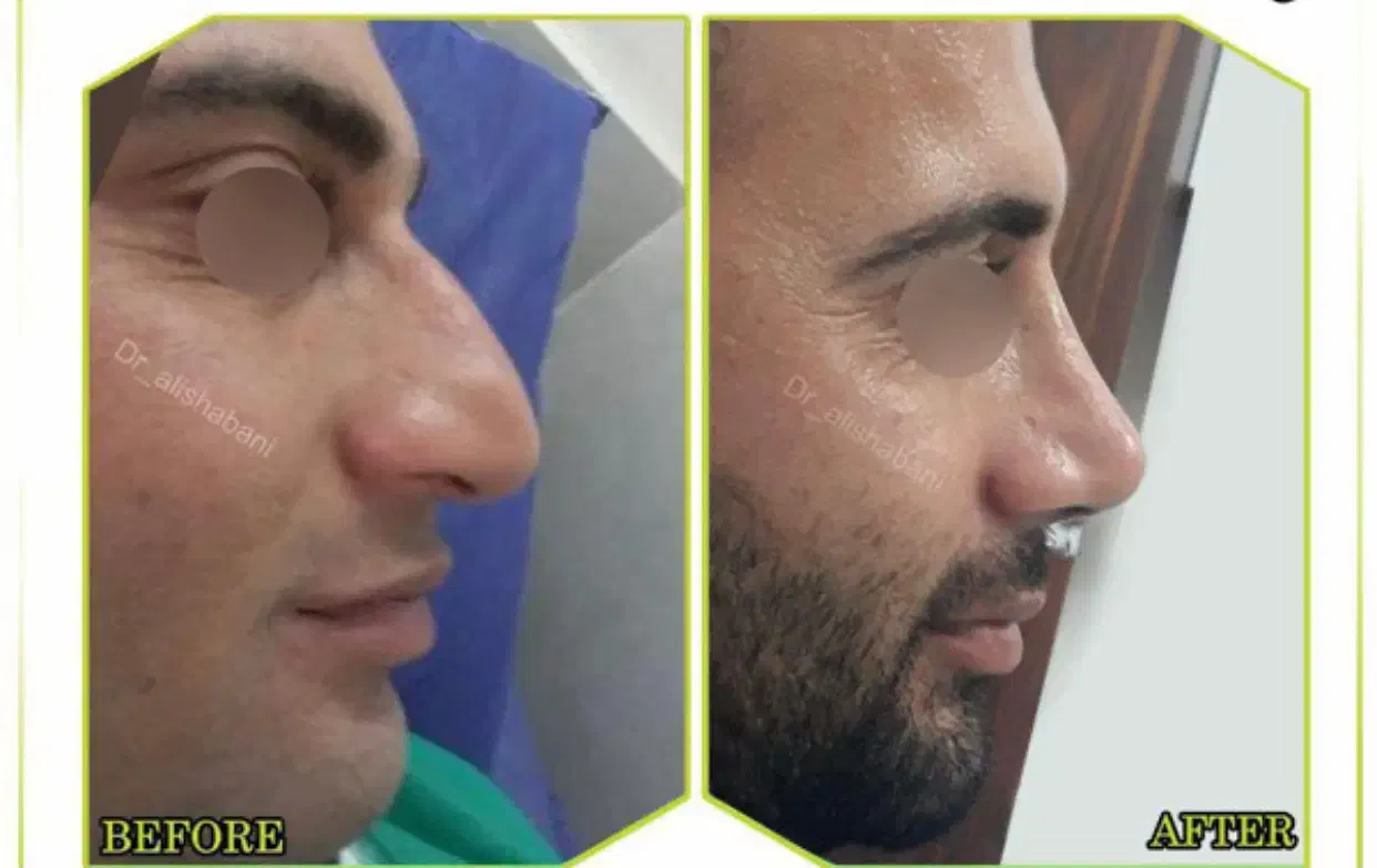 راهنمایی عمل بینی|فعالیت داوطلبانه تحقیقاتی|کرمان, |دیوار