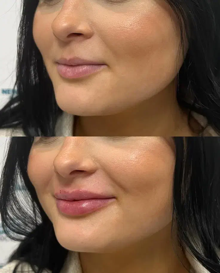 کلینیک تخصصی ژل و فیلر،لیپو و..|خدمات آرایشگری و زیبایی|شهریار, شهریار|دیوار