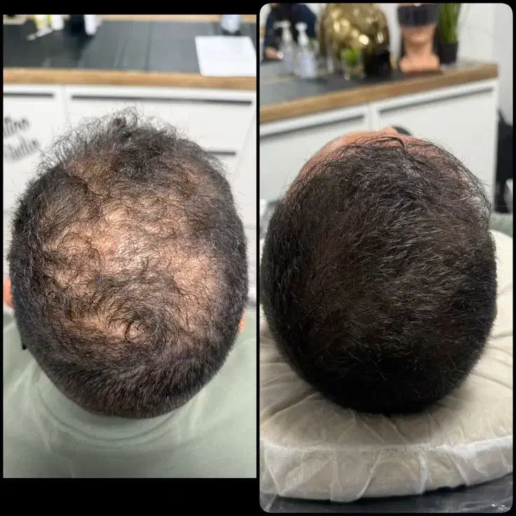 پذیرش مدل اسکالپ سر به صورت رایگان|خدمات آرایشگری و زیبایی|تهران, دروس|دیوار