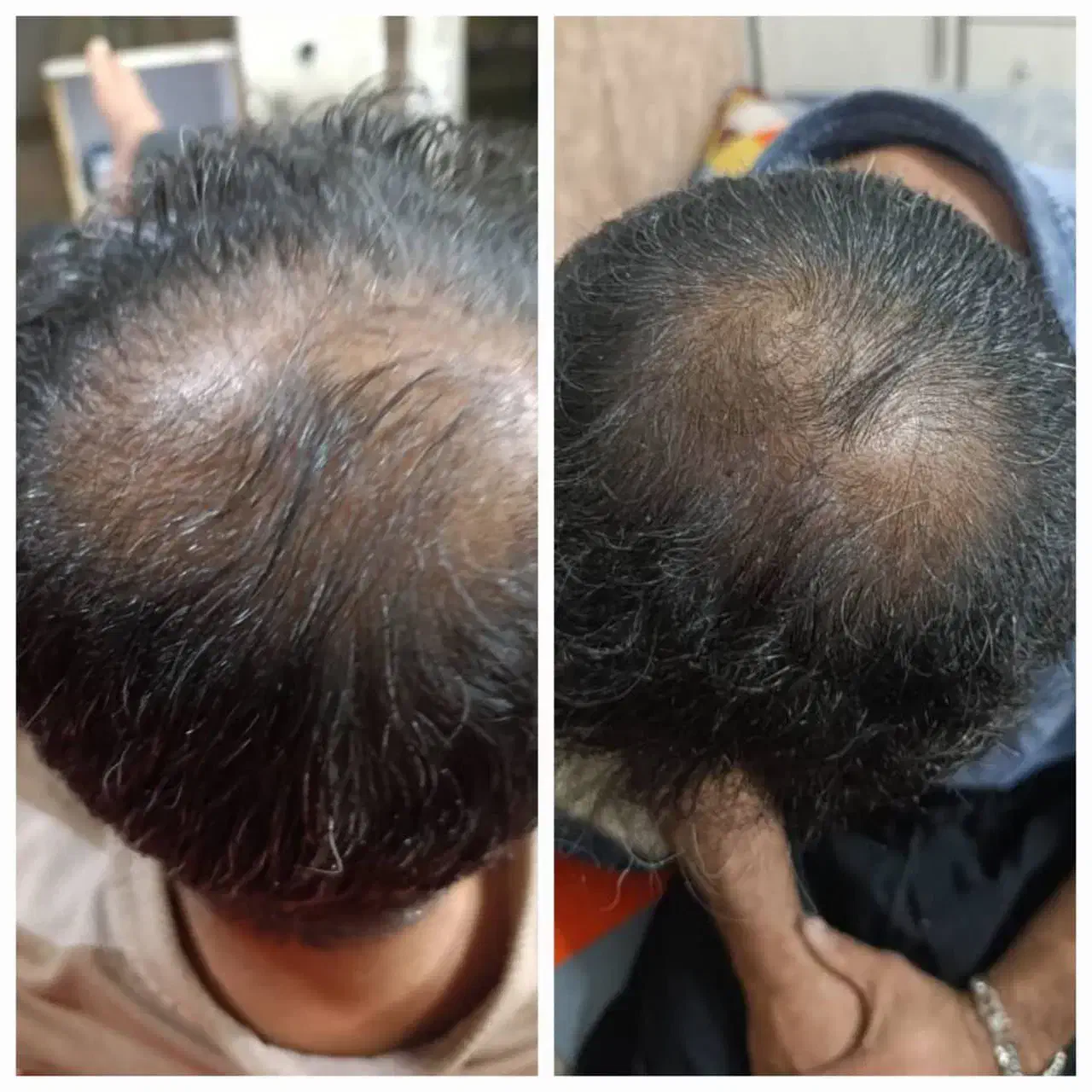 روغن های درمانی معجزه سلامتی|آرایشی، بهداشتی، درمانی|دورود, |دیوار