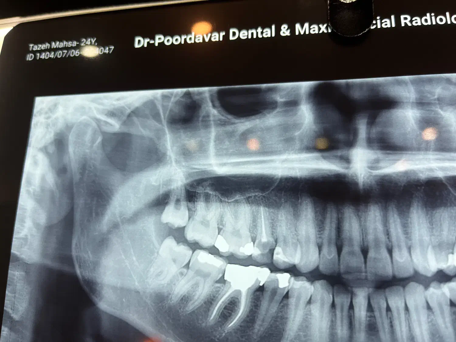 دستیار دندانپزشک|استخدام درمانی، زیبایی، بهداشتی|رشت, گلباغ نماز|دیوار