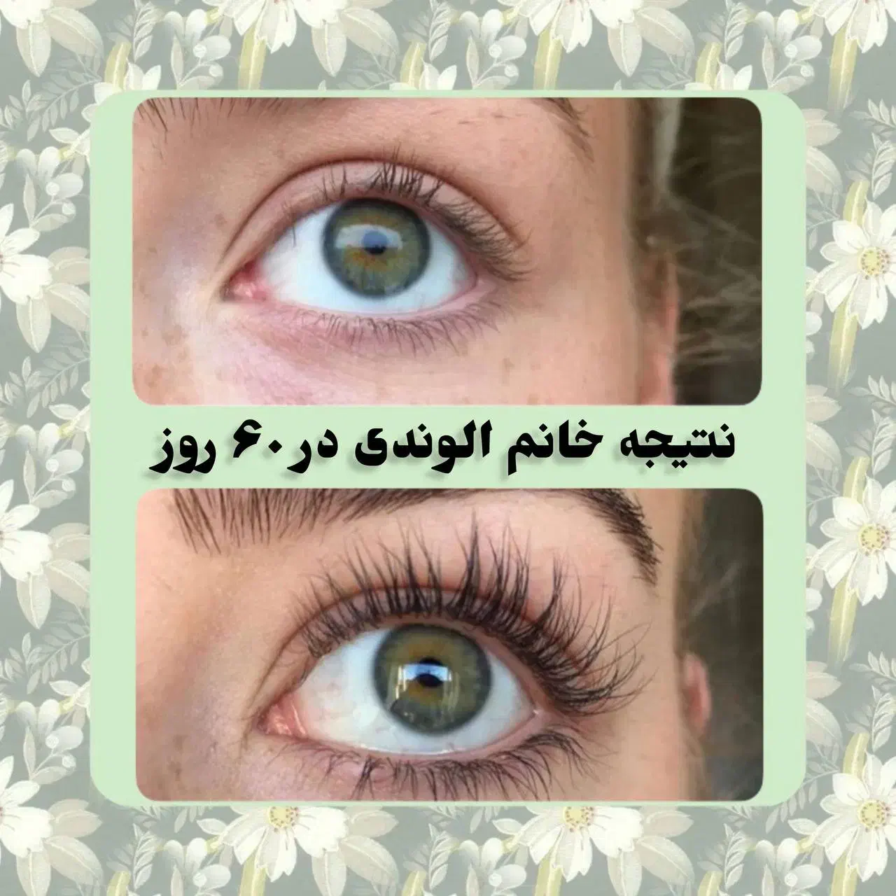مژه ها و ابروهات رو تقویت کن|خدمات آرایشگری و زیبایی|کرمانشاه, |دیوار