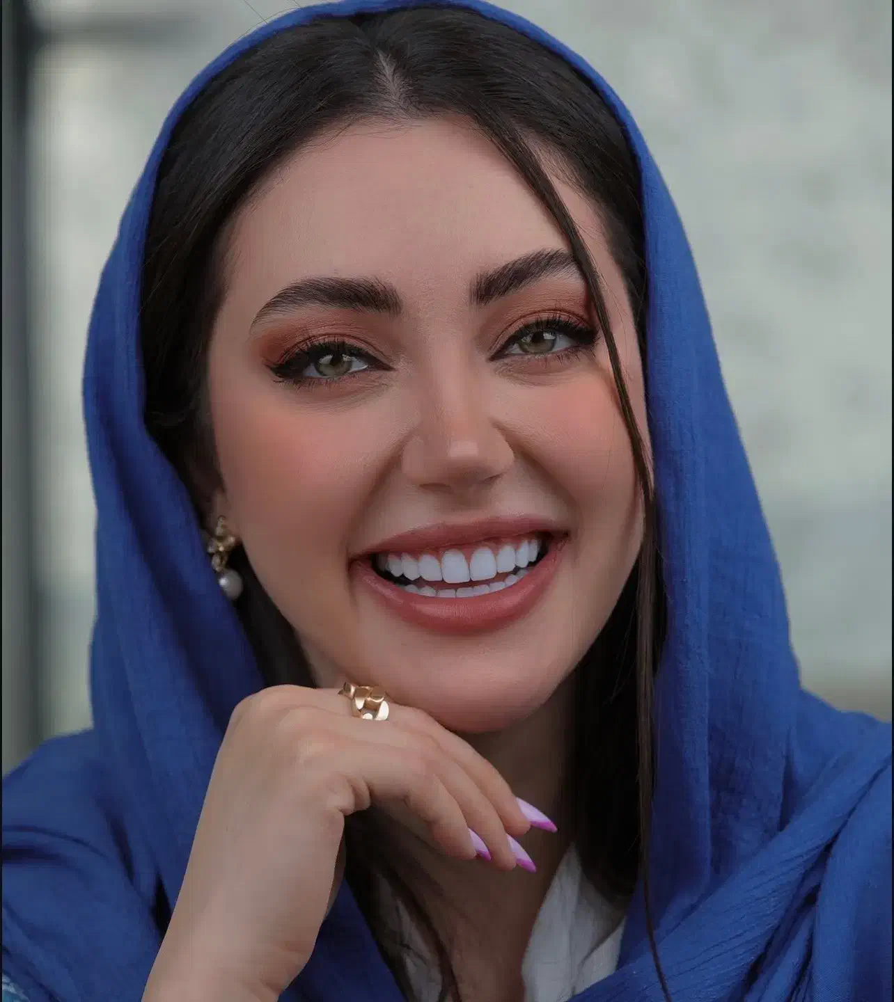 کامپوزیت دندان از دم قسط|خدمات آرایشگری و زیبایی|تهران, بلوار کشاورز|دیوار