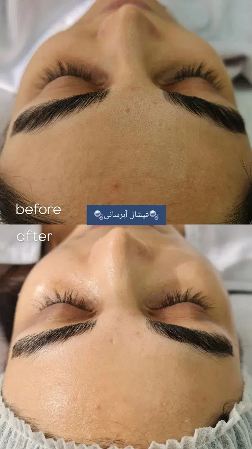 فیشال تخصصی با تخفیف ویژه مدت محدود|خدمات آرایشگری و زیبایی|لاهیجان, مهرگان|دیوار