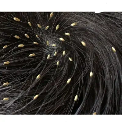 داروی صدرصد گیاهی رشکو و شپش|آرایشی، بهداشتی، درمانی|الوند, |دیوار