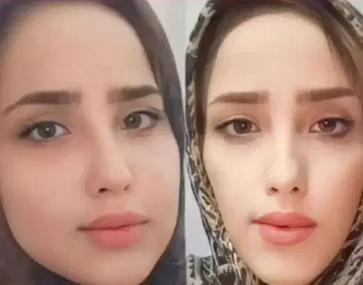 جوانه گندم|آرایشی، بهداشتی، درمانی|تهران, تهرانسر غربی|دیوار