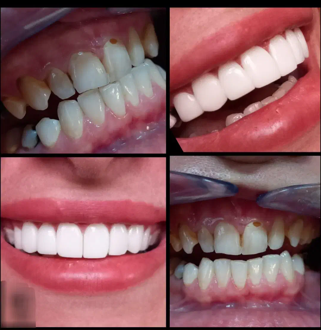 کامپوزیت زیبایی جشنواره ی تخفیفی یلدا|خدمات آرایشگری و زیبایی|کوهدشت, |دیوار