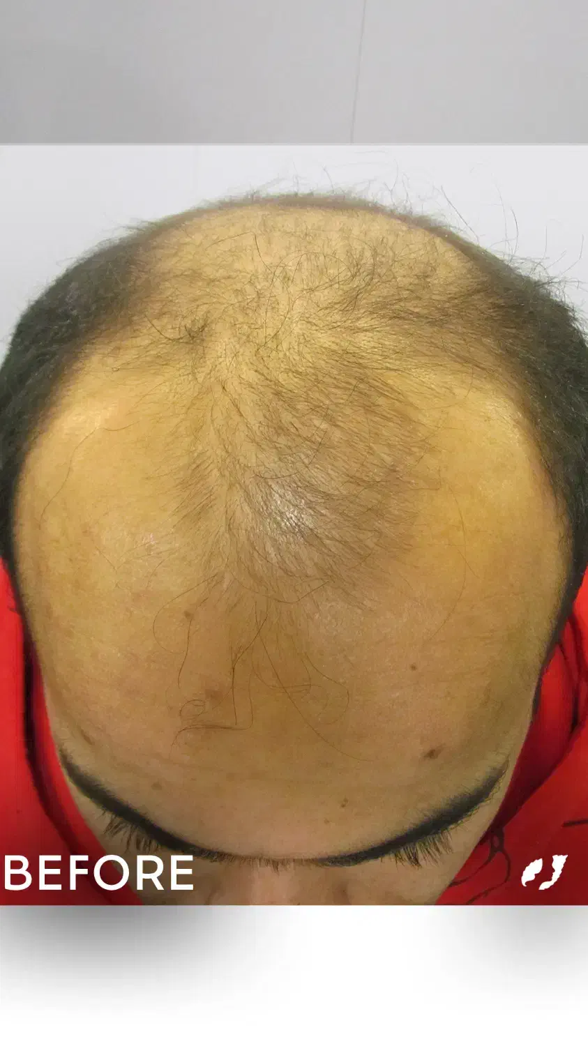 کاشتمو و ابرو|خدمات آرایشگری و زیبایی|تهران, جردن|دیوار