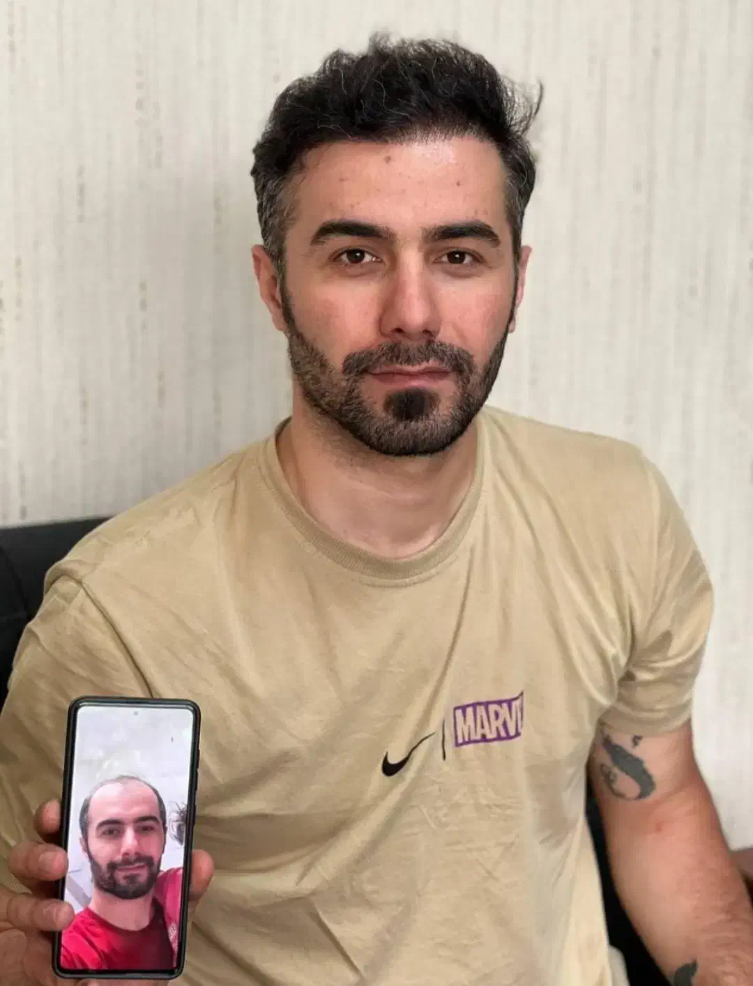 کاشت مو و ابرو|خدمات آرایشگری و زیبایی|بوشهر, |دیوار