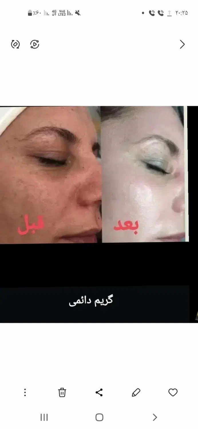 کرم پودر  و جوانساز|آرایشی، بهداشتی، درمانی|اهواز, یوسفی|دیوار