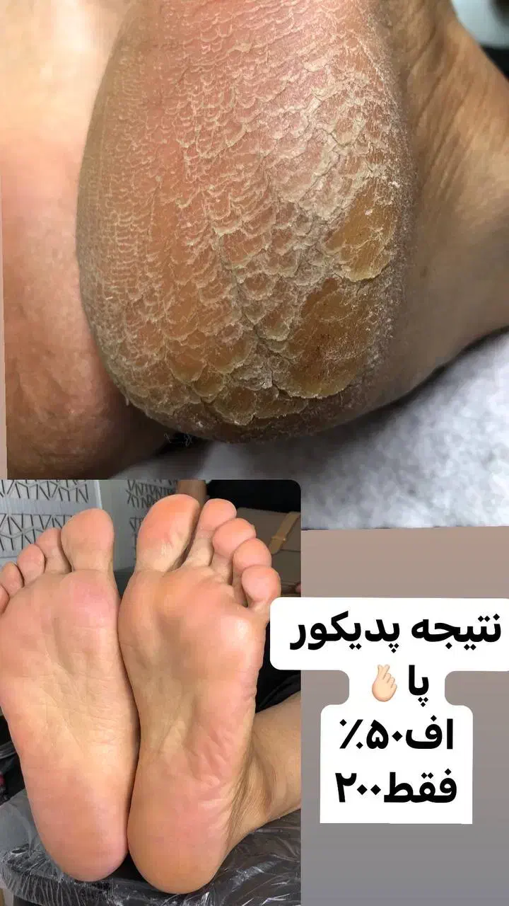 پدیکور پا ،رفع تیرگی ،قوزک پا|خدمات آرایشگری و زیبایی|پاکدشت, پاکدشت (مامازند)|دیوار