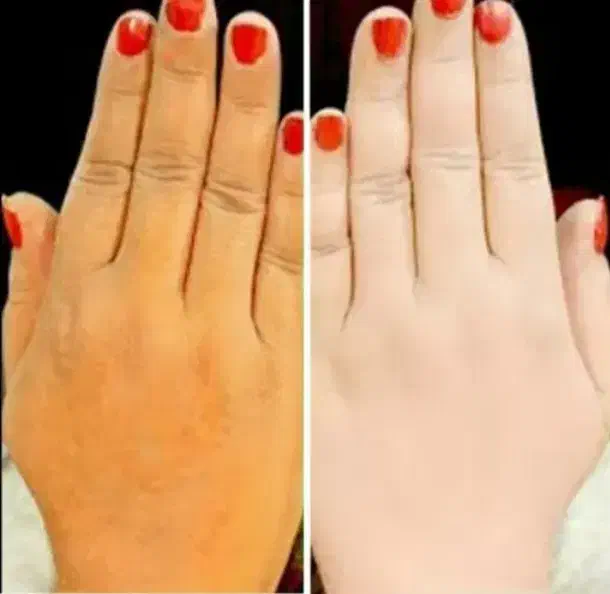 فرمول سفیدکننده دست وپا|آرایشی، بهداشتی، درمانی|جالق, |دیوار