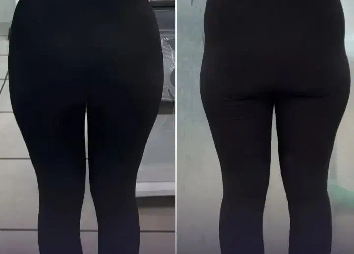 تزریق بوتاکس .ژل صورت .فیلر بادی . انزیم غبغب|خدمات آرایشگری و زیبایی|اسلامشهر, شهرک امام حسین (میان آباد)|دیوار