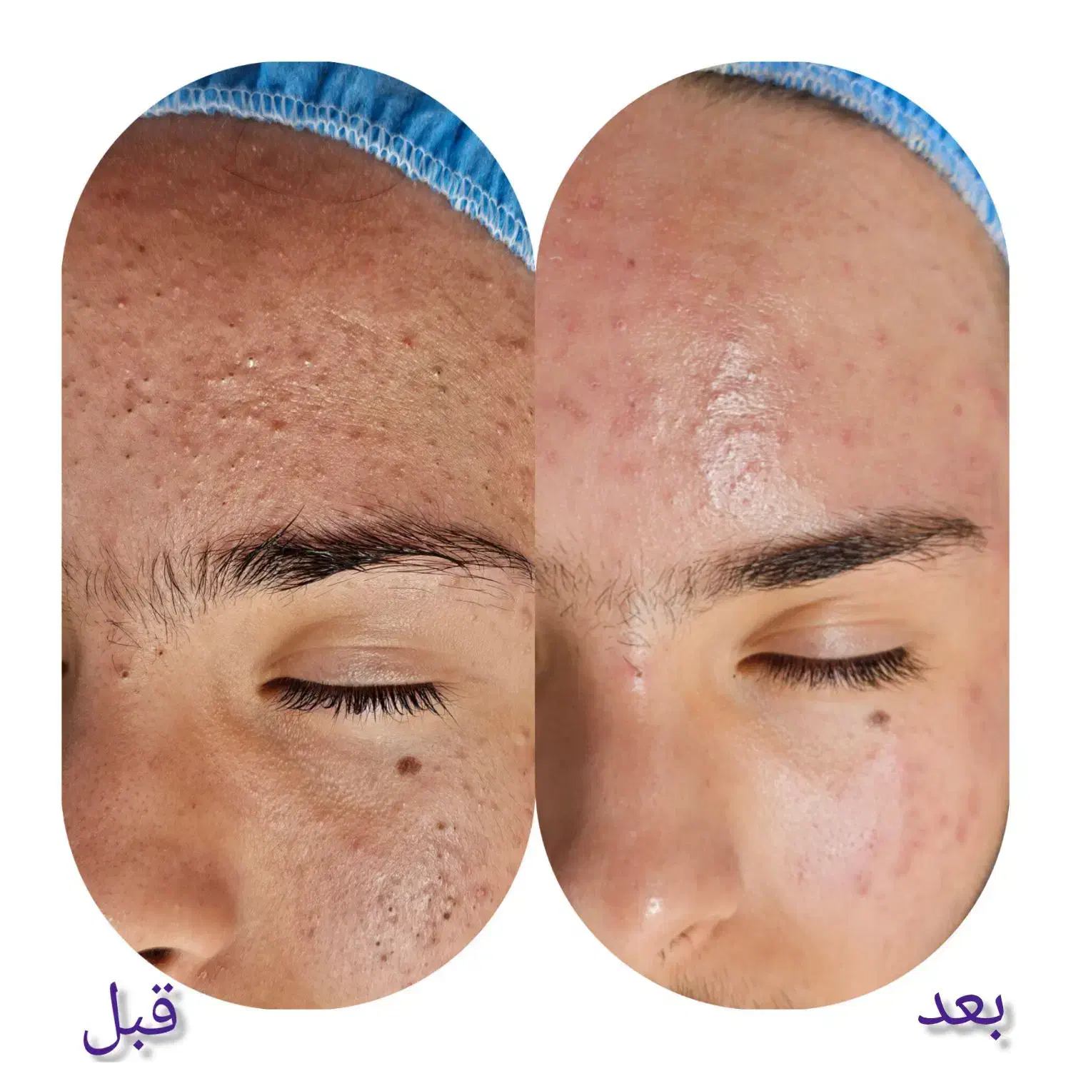 زیبایی ،پوست ،جراحی|خدمات آرایشگری و زیبایی|سهند, |دیوار