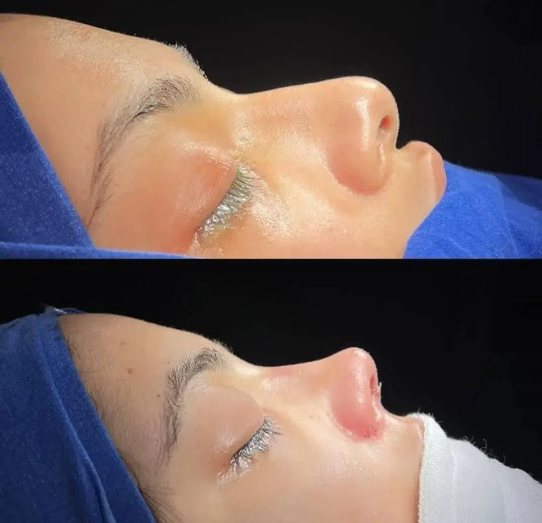 عمل بینی فقط با 50میلیون|خدمات آرایشگری و زیبایی|شیراز, قصرالدشت|دیوار