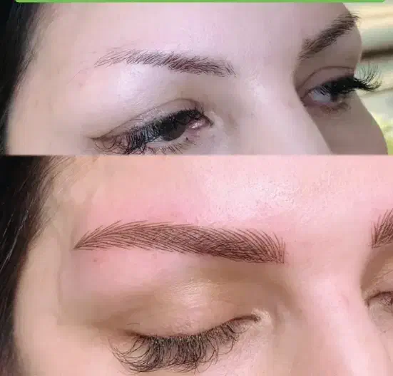 میکروبلیدینگ و میکروپیگمنتیشن وریموو و هیدرالیپس|خدمات آرایشگری و زیبایی|تهران, شهرک پرواز|دیوار