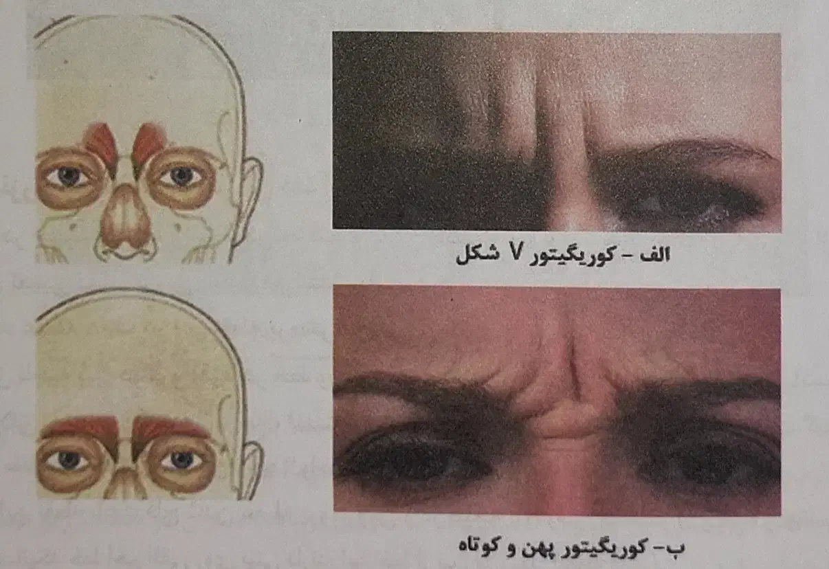 آموزش تزریق بوتاکس، فیلر، مزوتراپی|خدمات آموزشی|تهران, قیطریه|دیوار