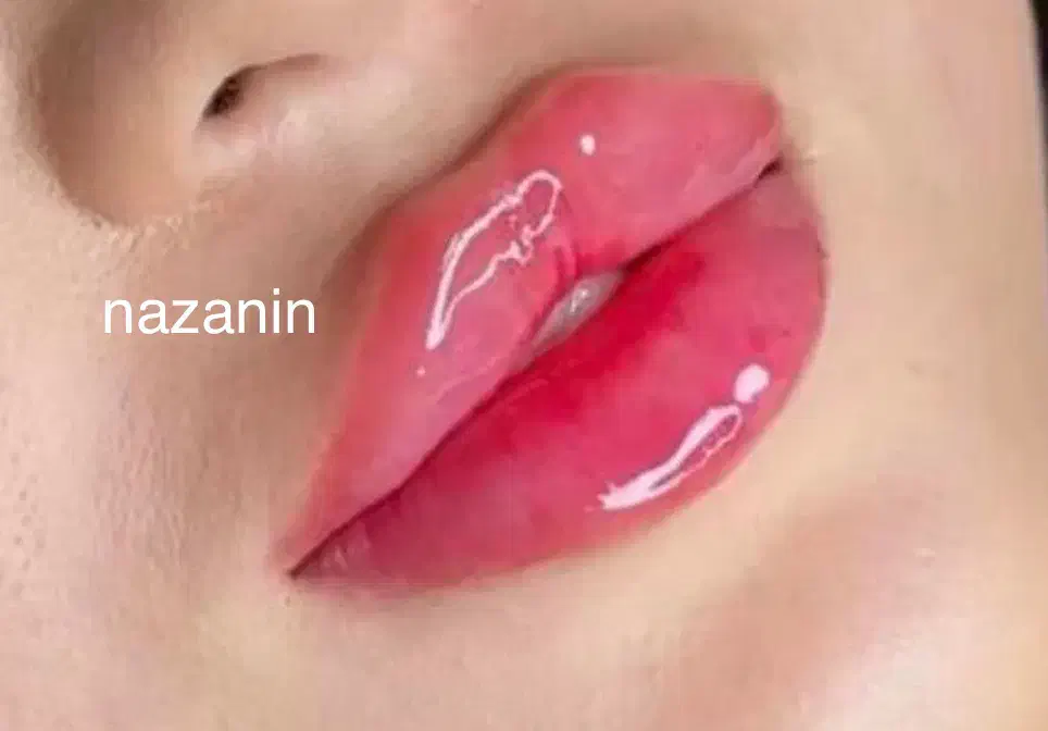 مطب گرگان عدالت ۱۳ بوتاکس ۸۰۰ ژل۱ تومان توسط پزشک|خدمات آرایشگری و زیبایی|گرگان, |دیوار