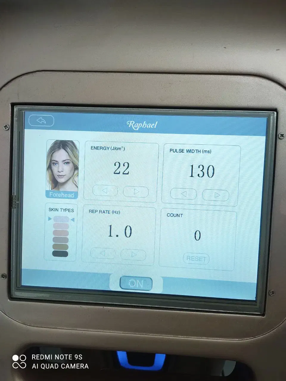 لیزر موهای زائد بدن|خدمات آرایشگری و زیبایی|مشهد, انقلاب|دیوار