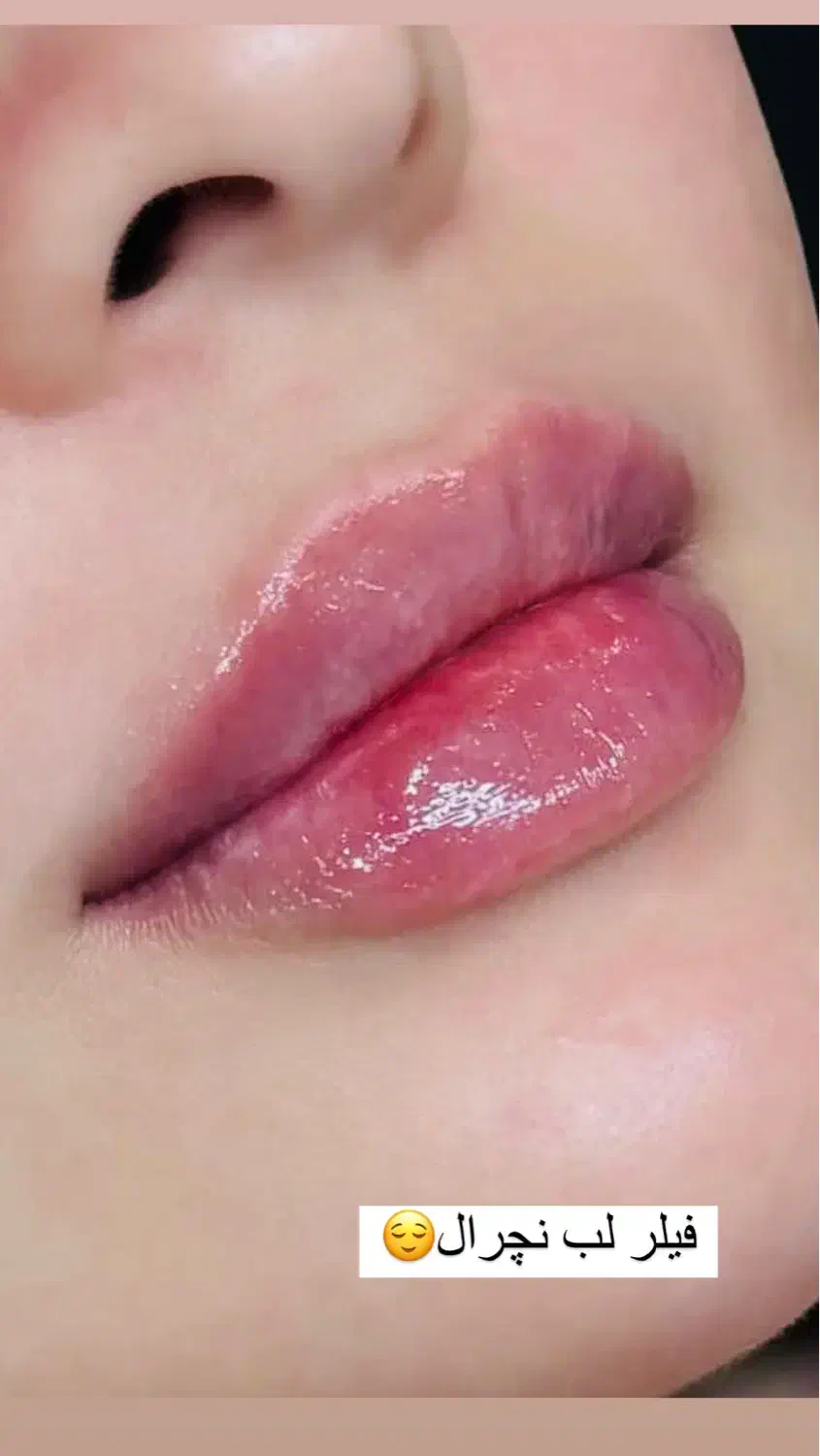 اف ویژه اموزش وخدمات ژل بوتاکس خال کراتین مژه|خدمات آرایشگری و زیبایی|اندیمشک, |دیوار