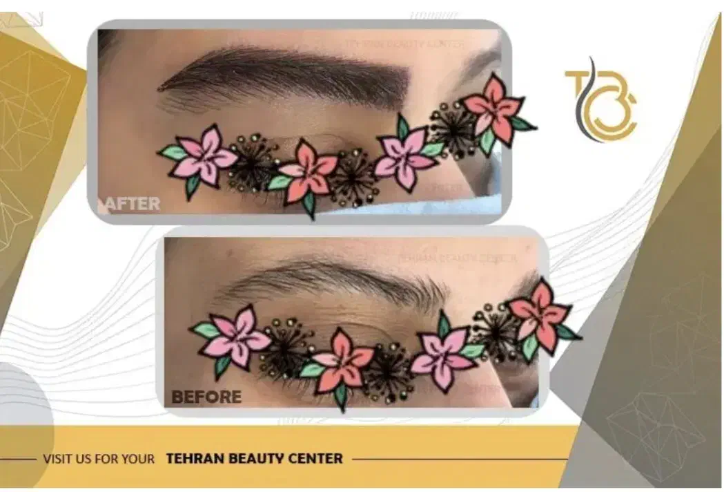 کاشت مو، کاشت ابرو، بلفارو، عمل بینی، رفع غبغب|خدمات آرایشگری و زیبایی|کرج, فاز ۱ مهرشهر|دیوار