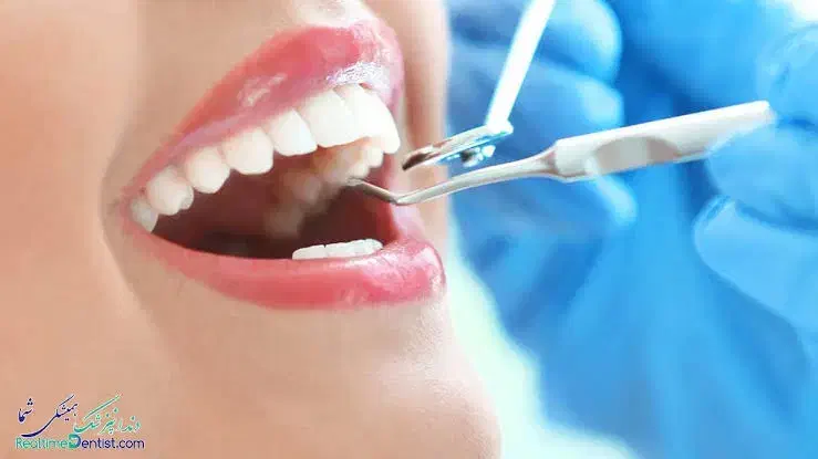 استخدام دستیار دندانپزشک|استخدام درمانی، زیبایی، بهداشتی|قرچک, باقرآباد|دیوار