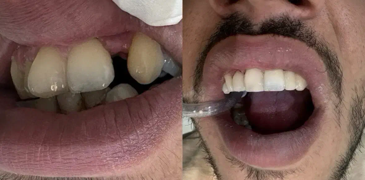 انجام کلیه خدمات دندانپزشکی قرارداد بانک سپه ورفاه|خدمات آرایشگری و زیبایی|فلاورجان, |دیوار