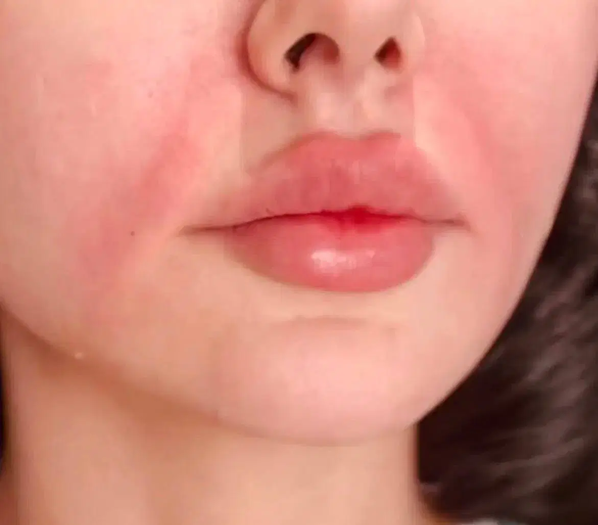 ارائه خدمات تخصصی ژل و بوتاکس|خدمات زیبایی و سلامت|شیراز, فرهنگ شهر|دیوار