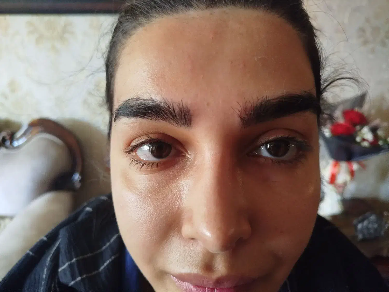 ژل بوتاکس مزو|خدمات آرایشگری و زیبایی|صدرا-فارس, فاز ۱|دیوار